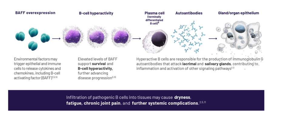 BAFF overexpression. Environmental factors may trigger epithelial and immune cells to release cytokines and chemokines, including B-cell activation factor (BAFF). B-cell hyperactivity. Elevated levels of BAFF support survival and B-cell hyperactivity, further advancing disease progression. Plasma cell (terminally differentiated B cell), Autoantibodies, and Gland/organ epithelium.