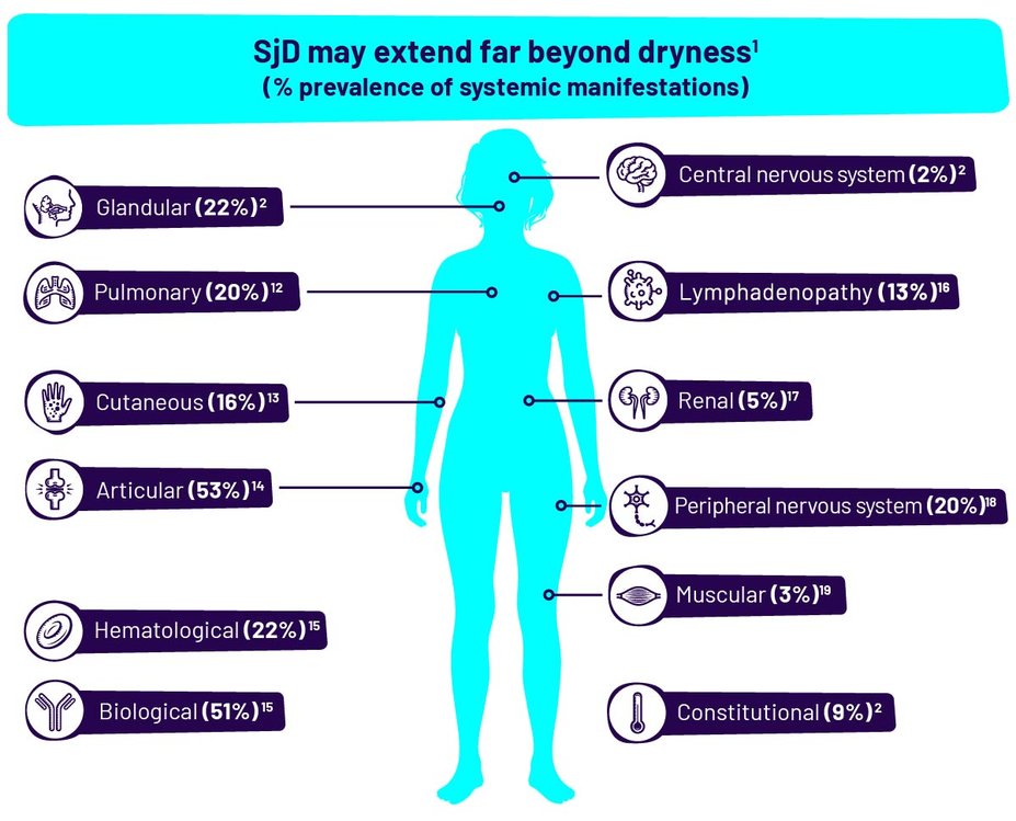 SjD may extend far beyond dryness (% prevalence of systemic manifestations). This includes the following percentages: Glandular (22%), Pulmonary (20%), Cutaneous (16%), Articular (53%), Hematological (22%), Biological (51%), Central nervous system (2%), Lymphadenopathy (13%), Renal (5%), Peripheral nervous system (20%), Muscular (3%), and Constitutional (9%).