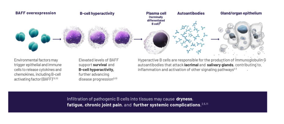 Environmental factors may trigger epithelial and immune cells to release cytokines and chemokines, including B-cell activating factor (BAFF). Elevated levels of BAFF support survival and B-cell hyperactivity, further advancing disease progression. Hyperactive B cells are responsible for the production of immunoglobulin G autoantibodies that attack lacrimal and salivary glands, contributing to inflammation and activation of other signaling pathways.