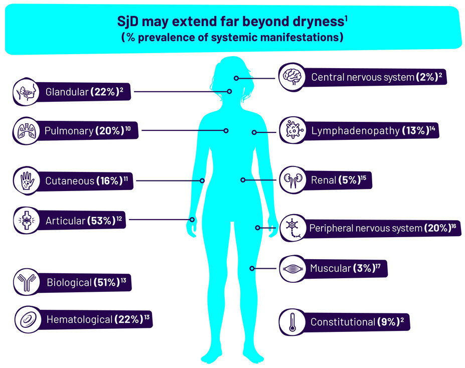 SjD may extend far beyond dryness (% prevalence of systemic manifestations). This includes the following percentages: Glandular (22%), Pulmonary (20%), Cutaneous (16%), Articular (53%), Biological (51%), Hematological (22%), Central nervous system (2%), Lymphadenopathy (13%), Renal (5%), Peripheral nervous system (20%), Muscular (3%), and Constitutional (9%).