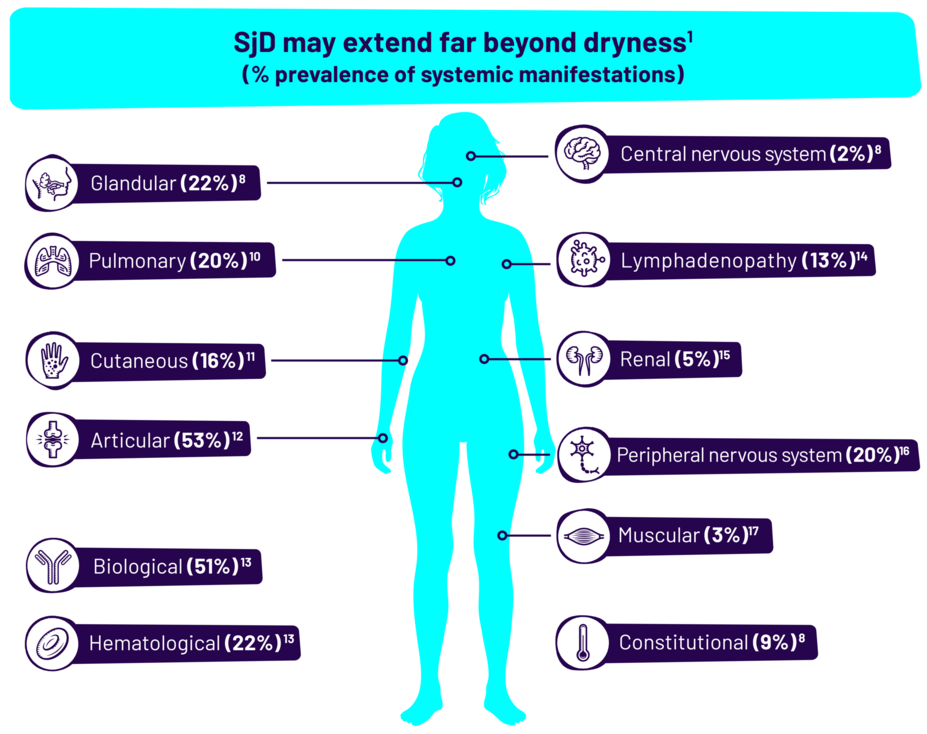 SjD may extend far beyond dryness (% prevalence of systemic manifestations). This includes the following percentages: Glandular (22%), Pulmonary (20%), Cutaneous (16%), Articular (53%), Biological (51%), Hematological (22%), Central nervous system (2%), Lymphadenopathy (13%), Renal (5%), Peripheral nervous system (20%), Muscular (3%), and Constitutional (9%).