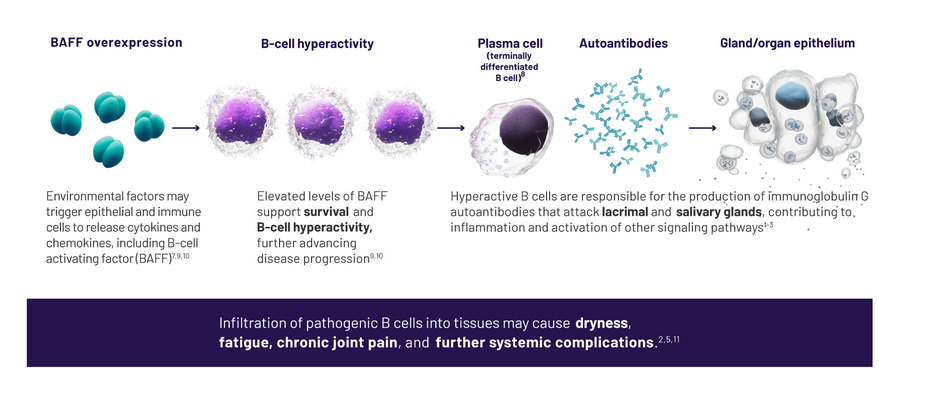 Environmental factors may trigger epithelial and immune cells to release cytokines and chemokines, including B-cell activating factor (BAFF). Elevated levels of BAFF support survival and B-cell hyperactivity, further advancing disease progression. Hyperactive B cells are responsible for the production of immunoglobulin G autoantibodies that attack lacrimal and salivary glands, contributing to inflammation and activation of other signaling pathways.