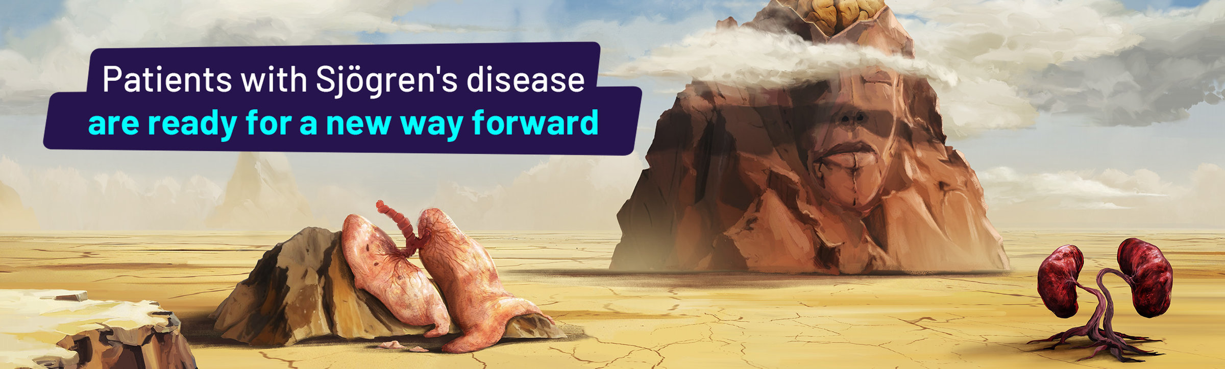 Patients with Sjögren’s disease are ready for a new way forward.