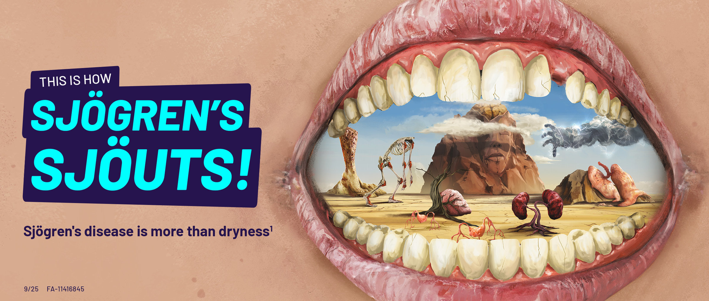 Sjögren’s disease is more than dryness.