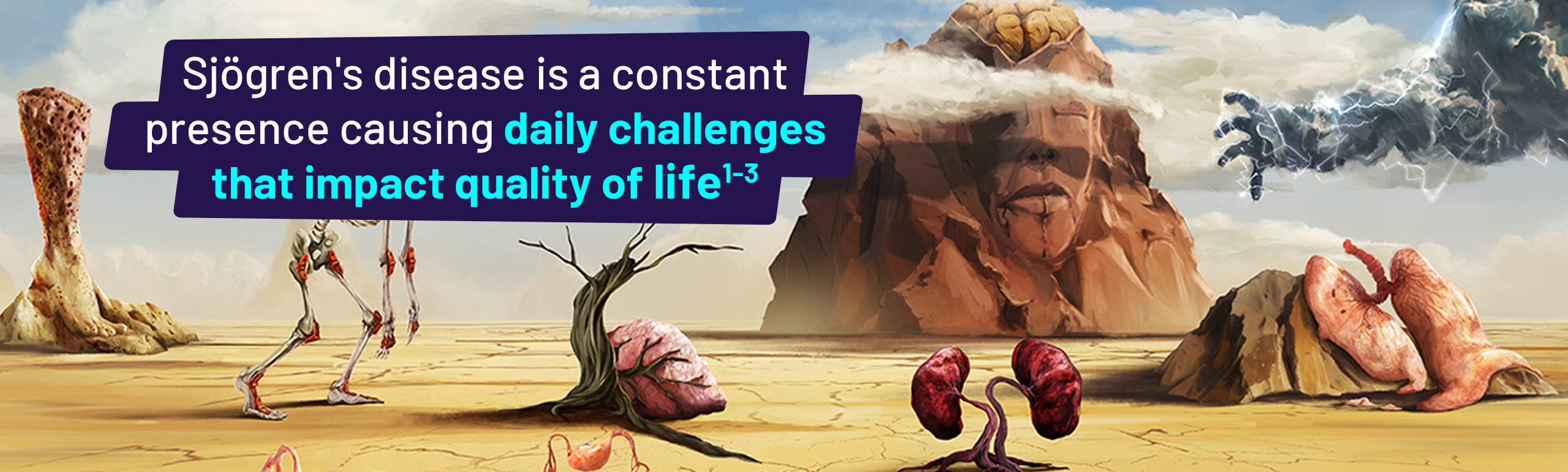 Sjögren’s disease is a constant presence causing daily challenges that impact quality of life.